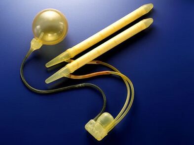 penile prosthesis
